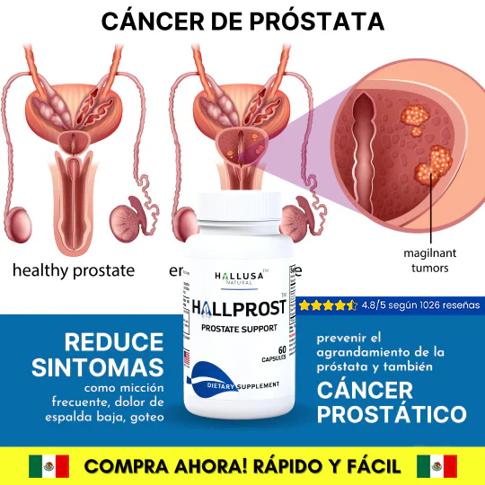 HALLPROST  Tratamiento Completo V3