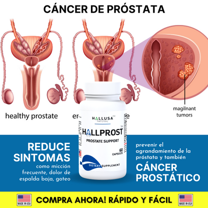 HALLPROST - Tratamiento para 2 meses